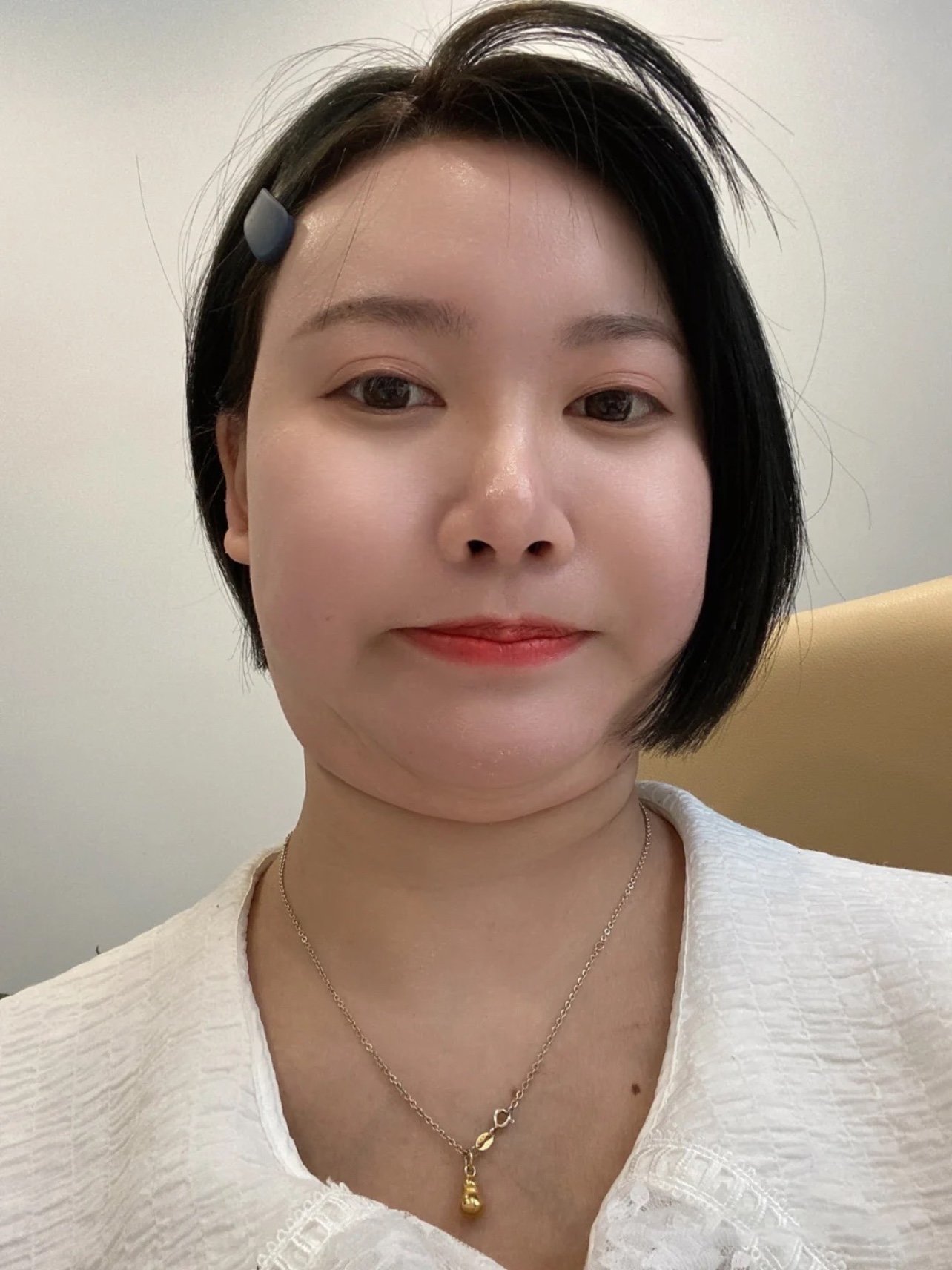 平常低头玩手机久了就感觉自己出现了双下巴就感觉胖了_圈子-新氧美容