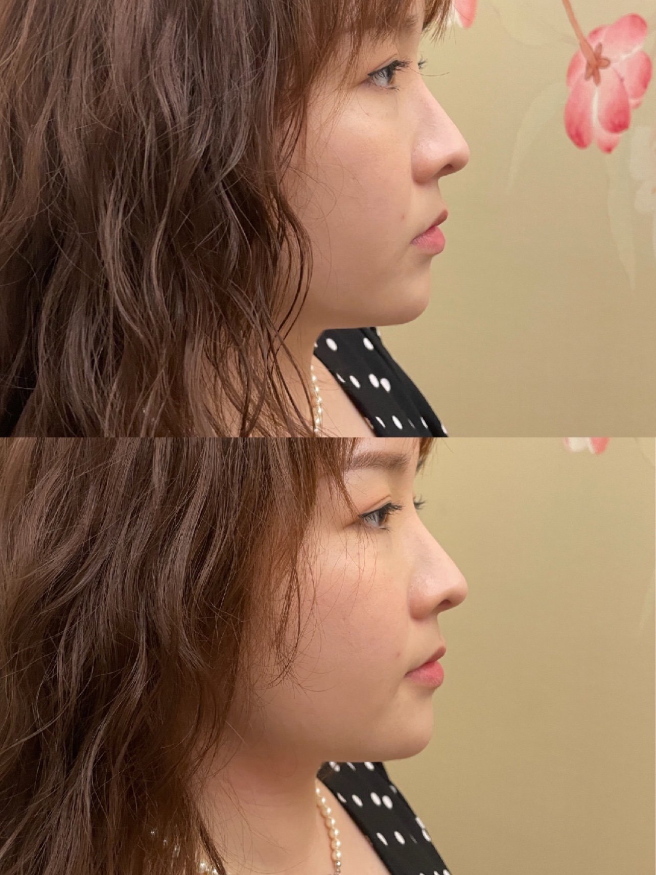 距离白白体验火凤凰无创溶脂祛双下巴的第二次,也已经有半个月的时间