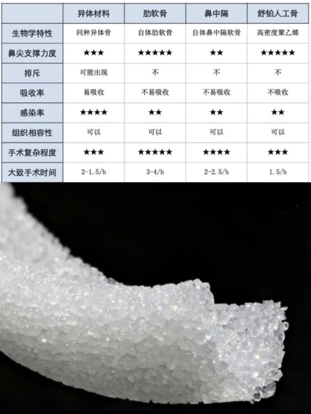 肋骨鼻到底好不好_肋骨鼻好么_超肋好还是肋骨鼻好