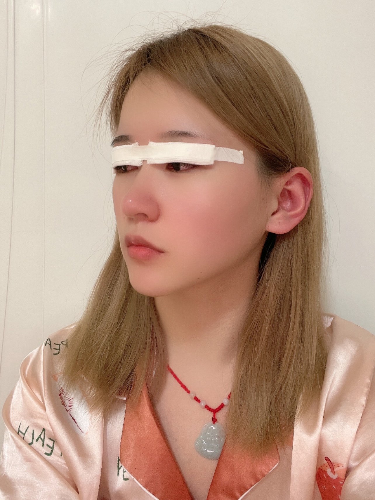 眼睛上贴这么块纱布_圈子-新氧美容整形