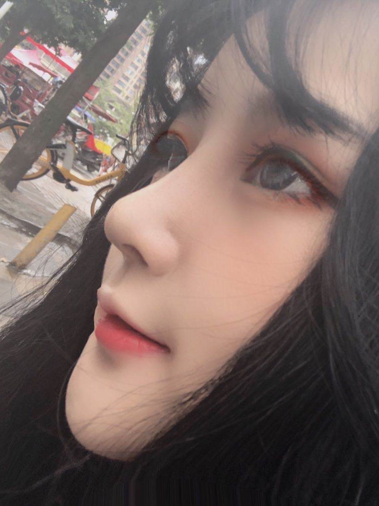 患者鼻小柱过短,侧面看上去鼻子很短鼻梁塌,鼻翼肥大_圈子-新氧美容