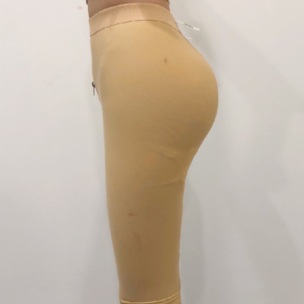 假体丰臀案例分享整形医生案例大赏