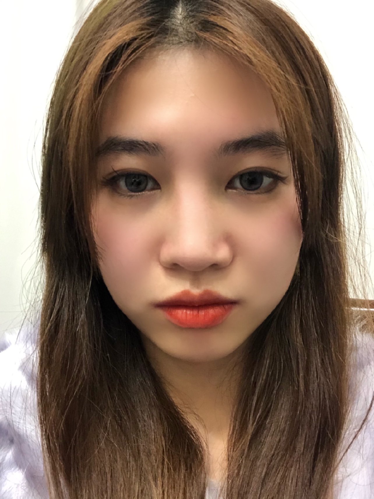 我的鼻子属于典型的亚洲鼻,肉鼻头,鼻梁低,鼻背宽,又有点轻微的驼峰鼻