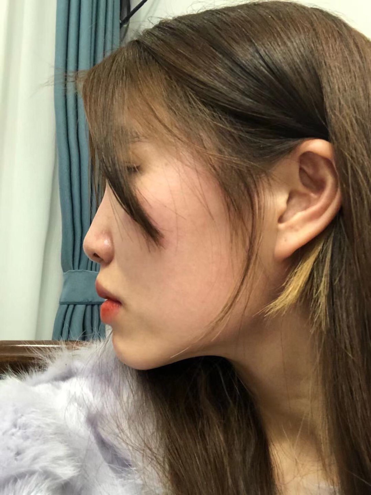 我的鼻子属于典型的亚洲鼻,肉鼻头,鼻梁低,鼻背宽,又有点轻微的驼峰鼻