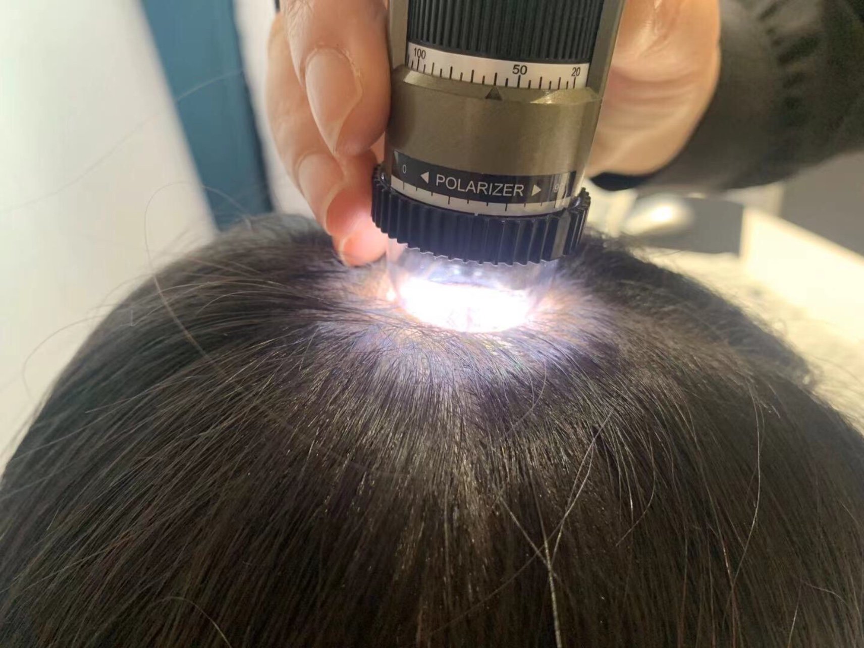 抽到了我头发一直都很稀疏感觉快秃了还脱发所以头皮保养更是要做起来