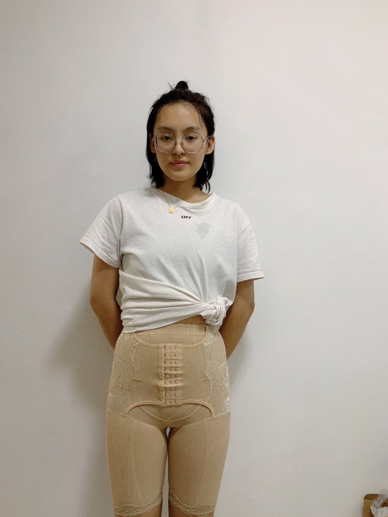 做完大腿吸脂已经马上,这段时间一直都坚持穿塑身裤,_圈子-新氧美容