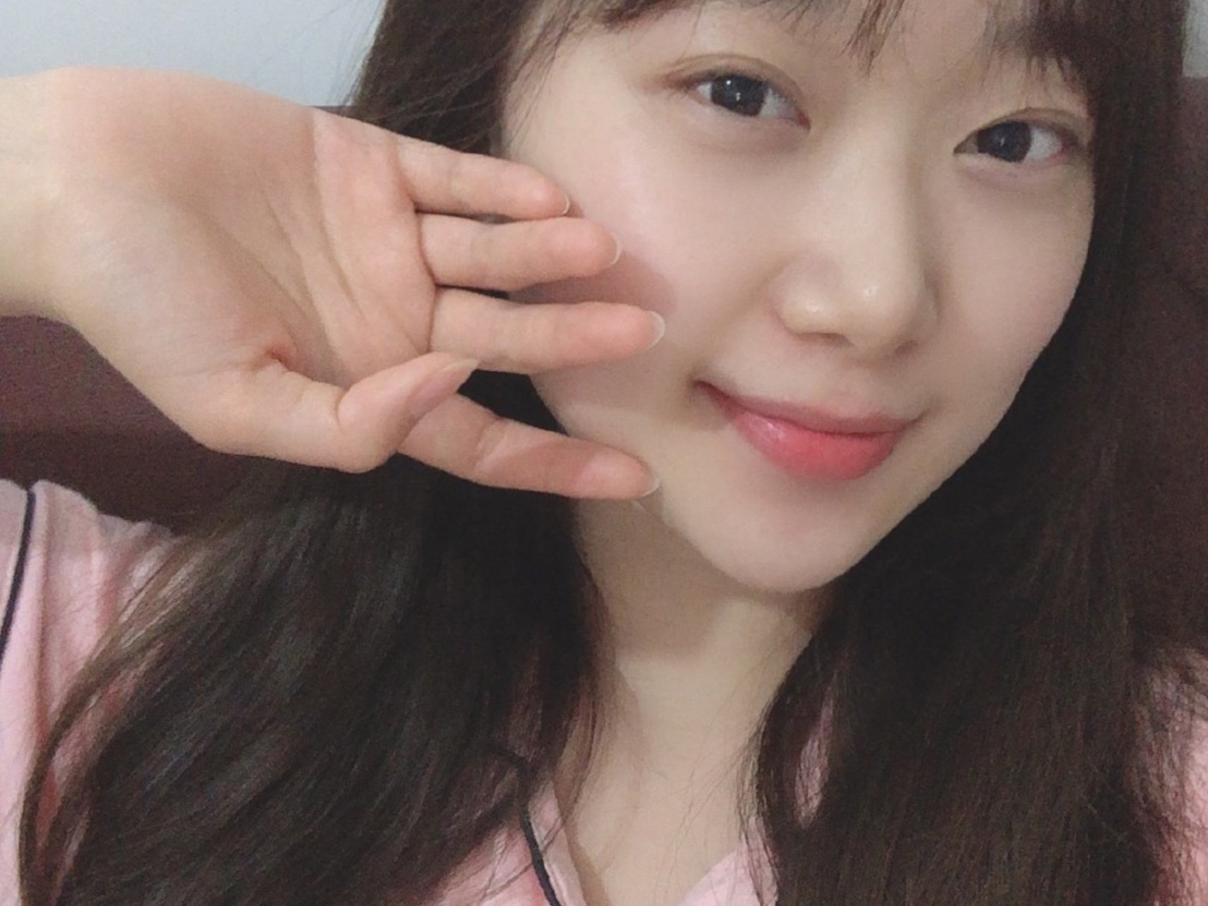 项目体验完,皮肤状态好很多,纯素颜能看出来变化,性_圈子-新氧美容