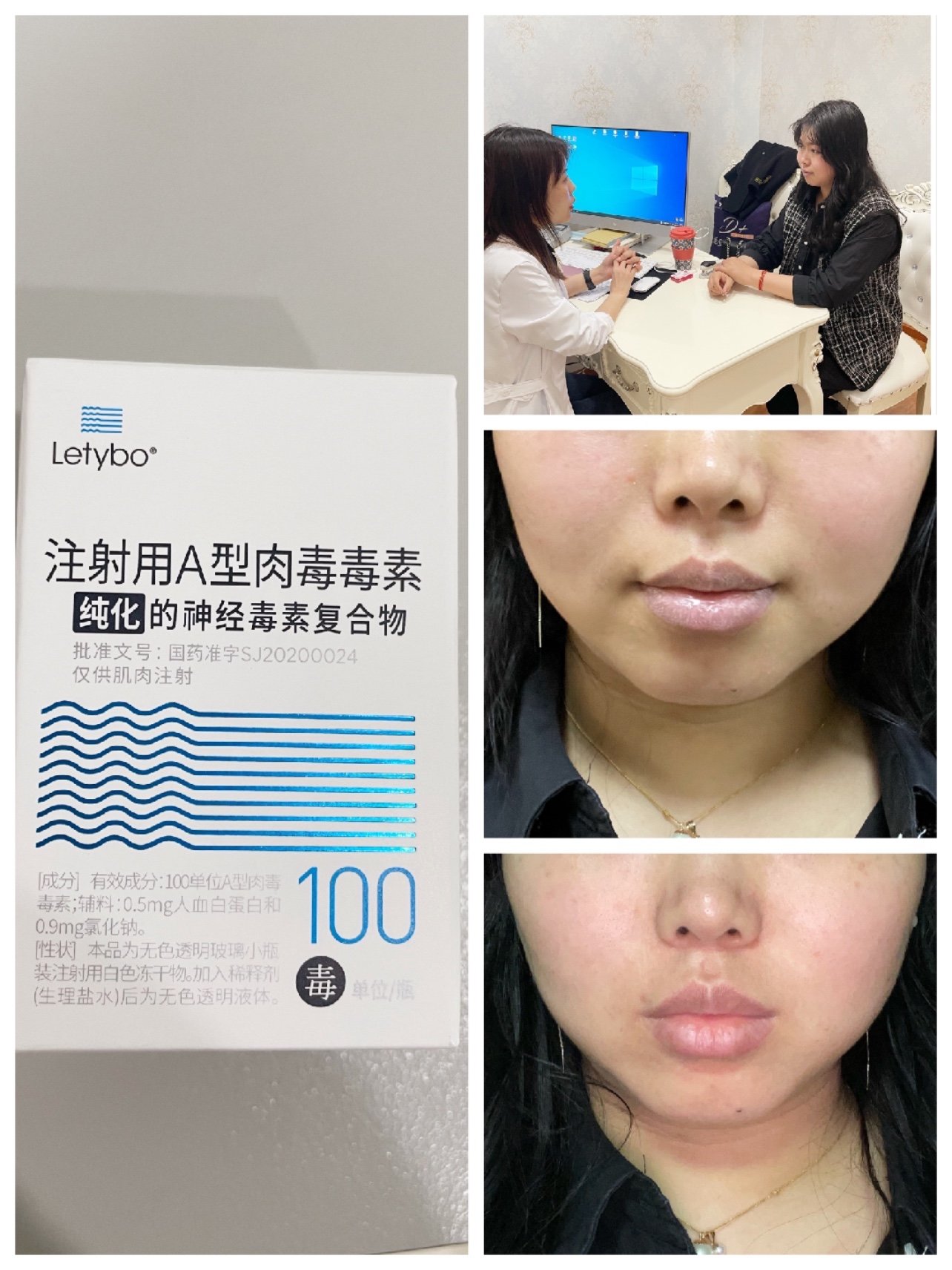 新氧体验官韩国瘦脸针