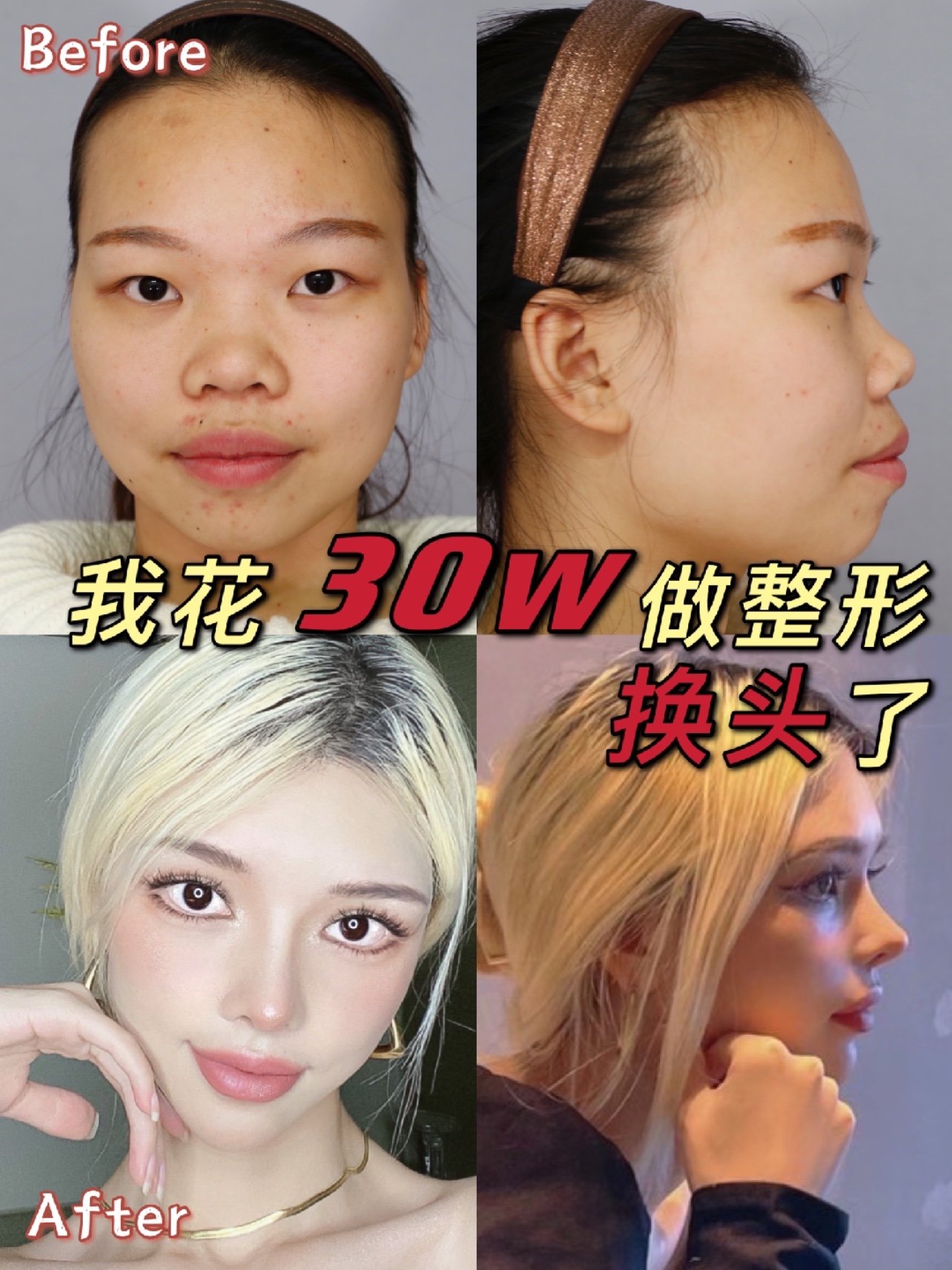 但是评论区很多姐妹都不知道我到底做了什么项目,大概多少钱?