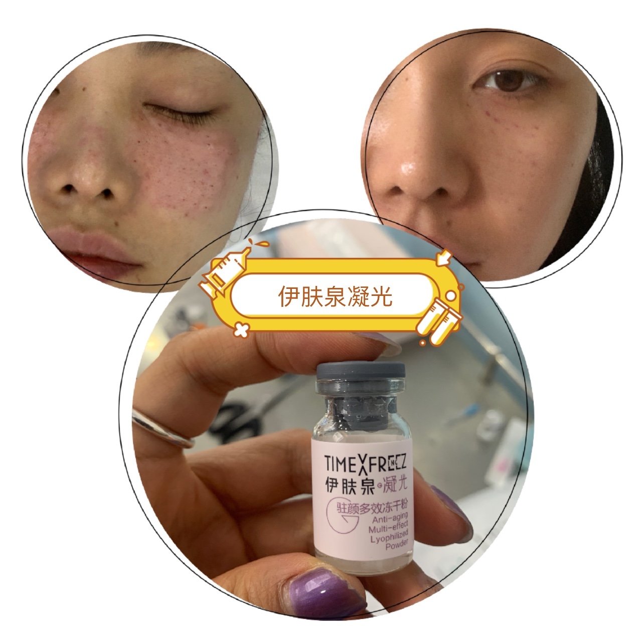 新氧试用官伊肤泉凝光