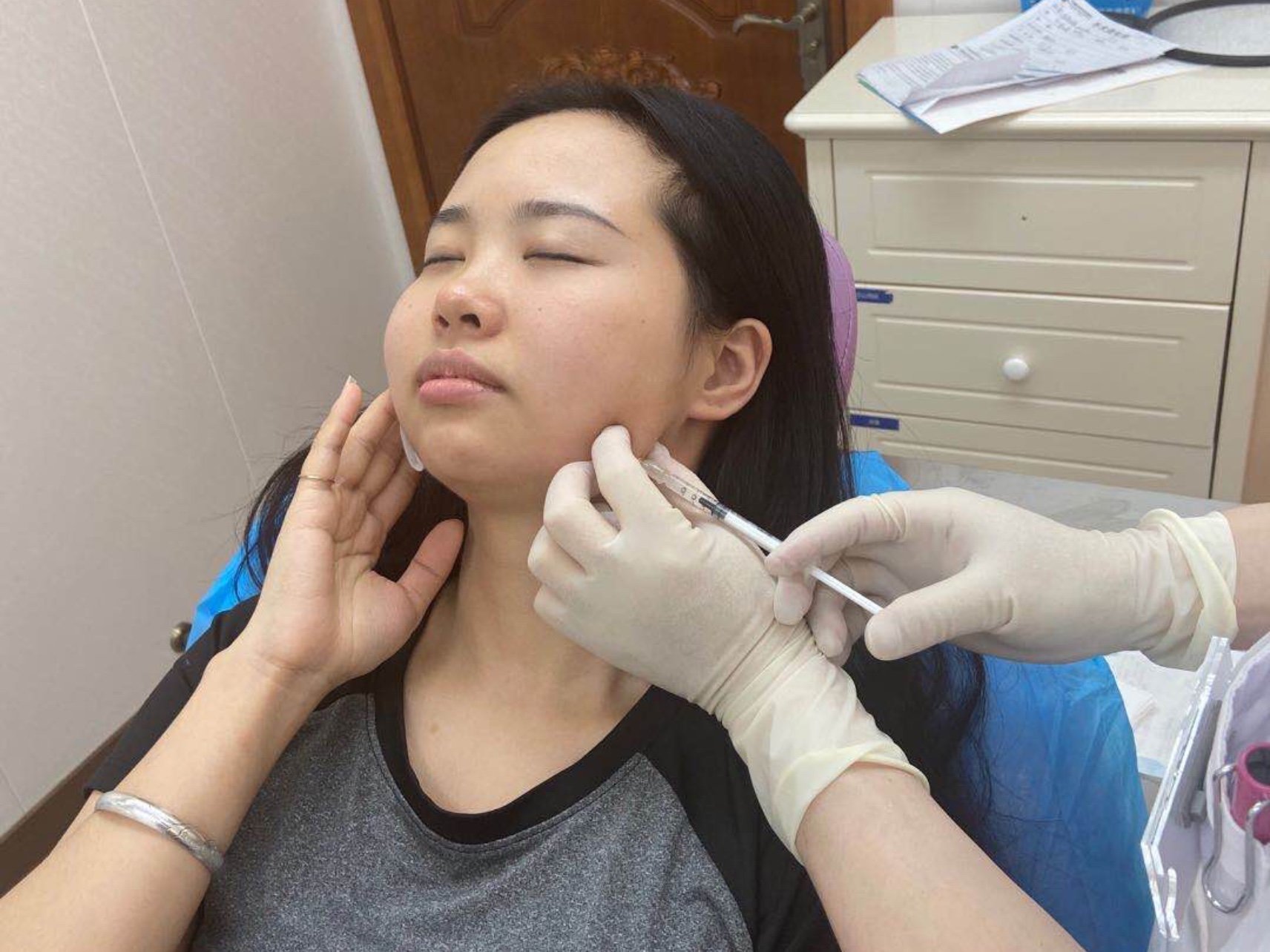 转眼之间打了瘦脸针已经过了好几个月了我的咬肌有回来一些但是对比没