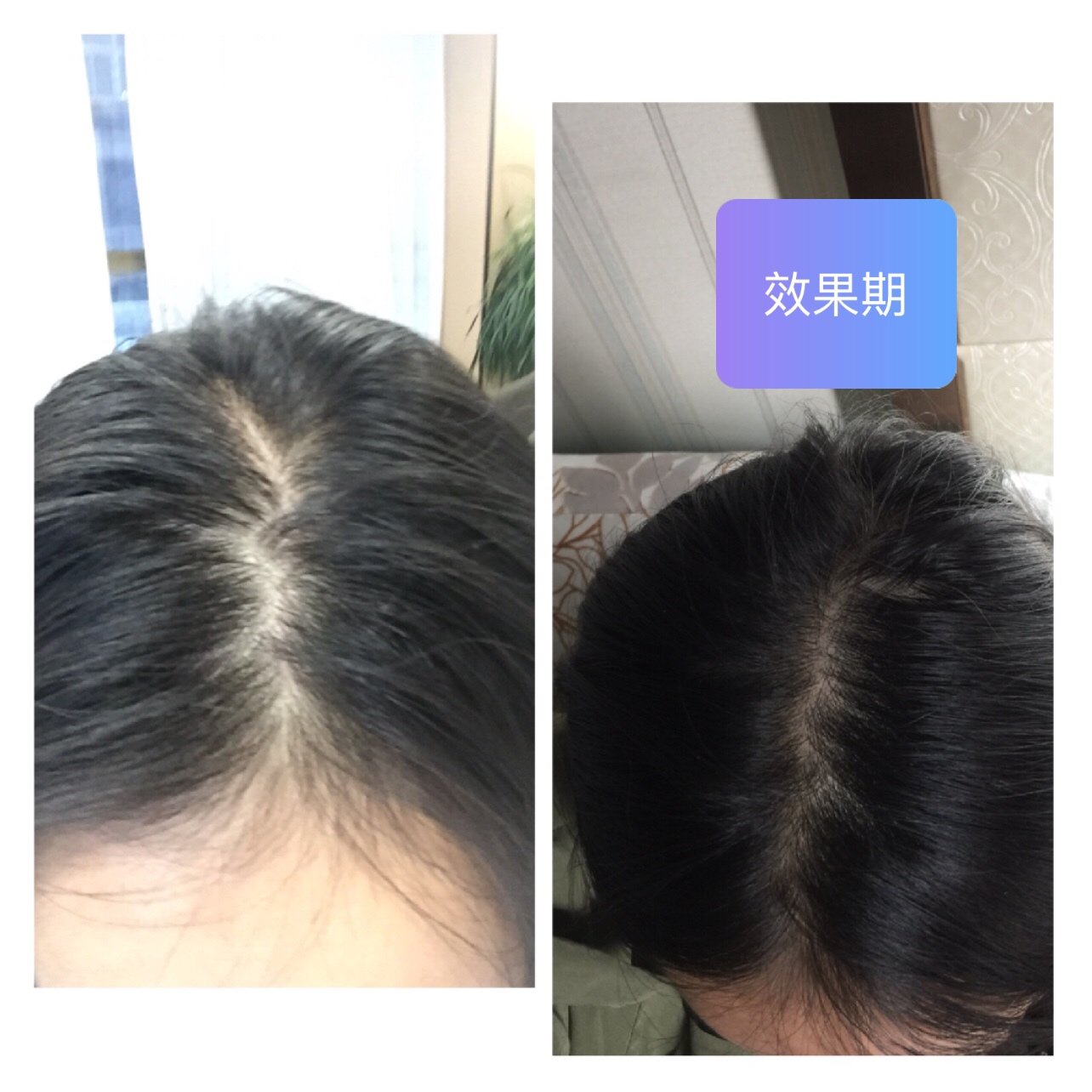 头皮美塑丝丽小红帽