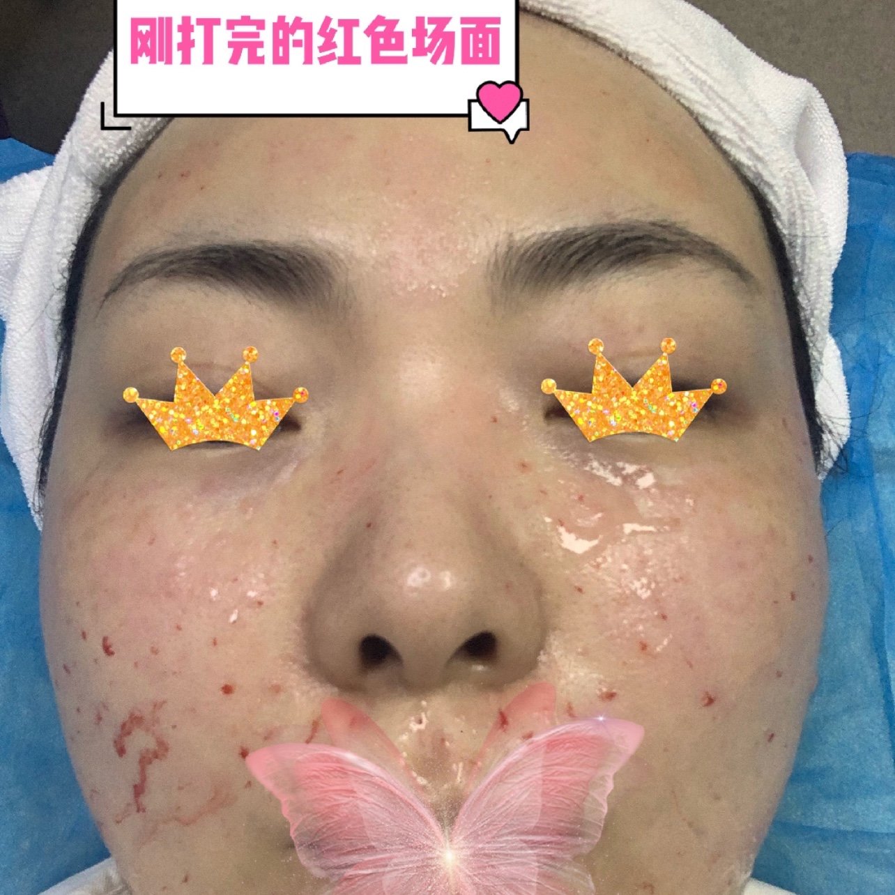 新氧体验官ert凝光水光