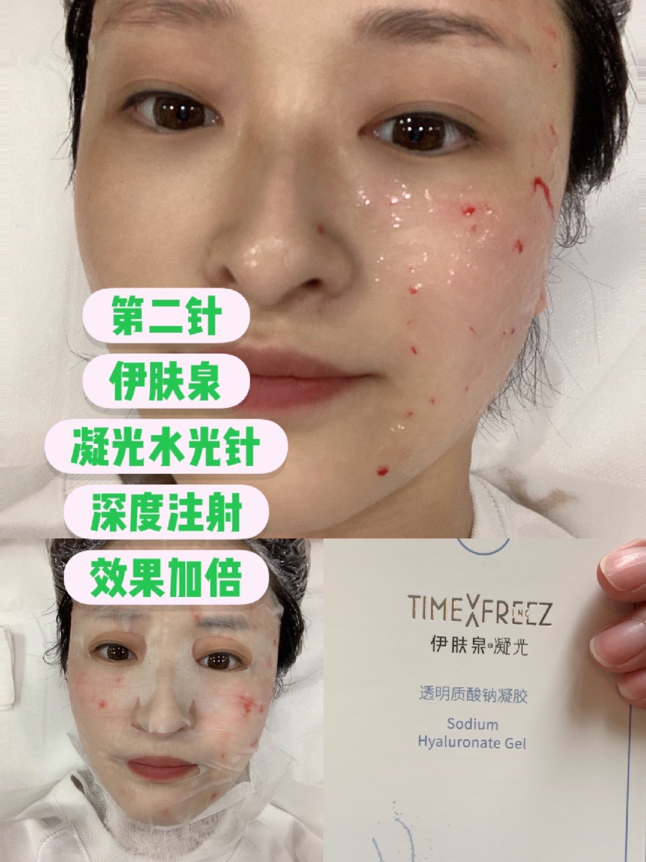 新氧试用官伊肤泉凝光