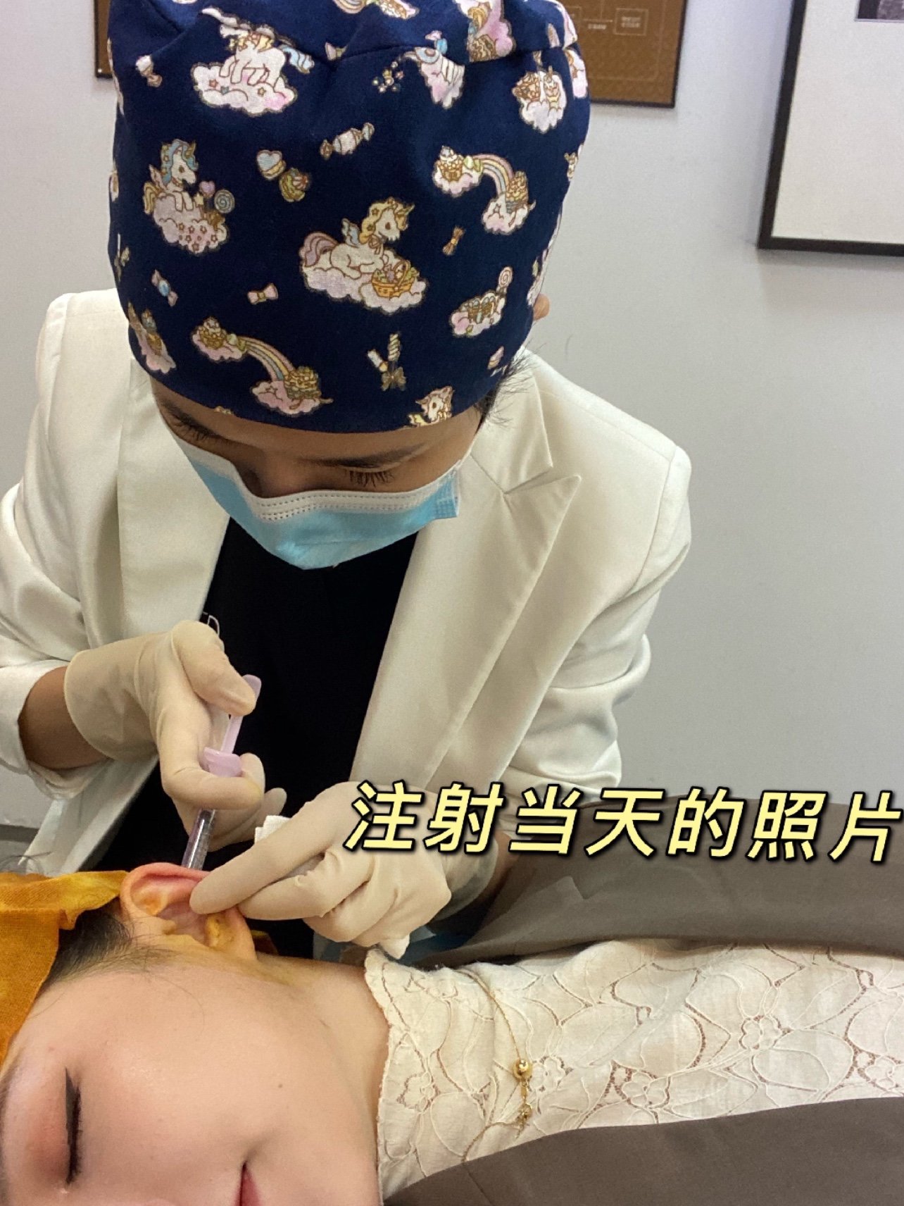 "精灵耳"注射一个多月了,到底有啥用?这么多玻尿酸_圈子-新氧美容整形