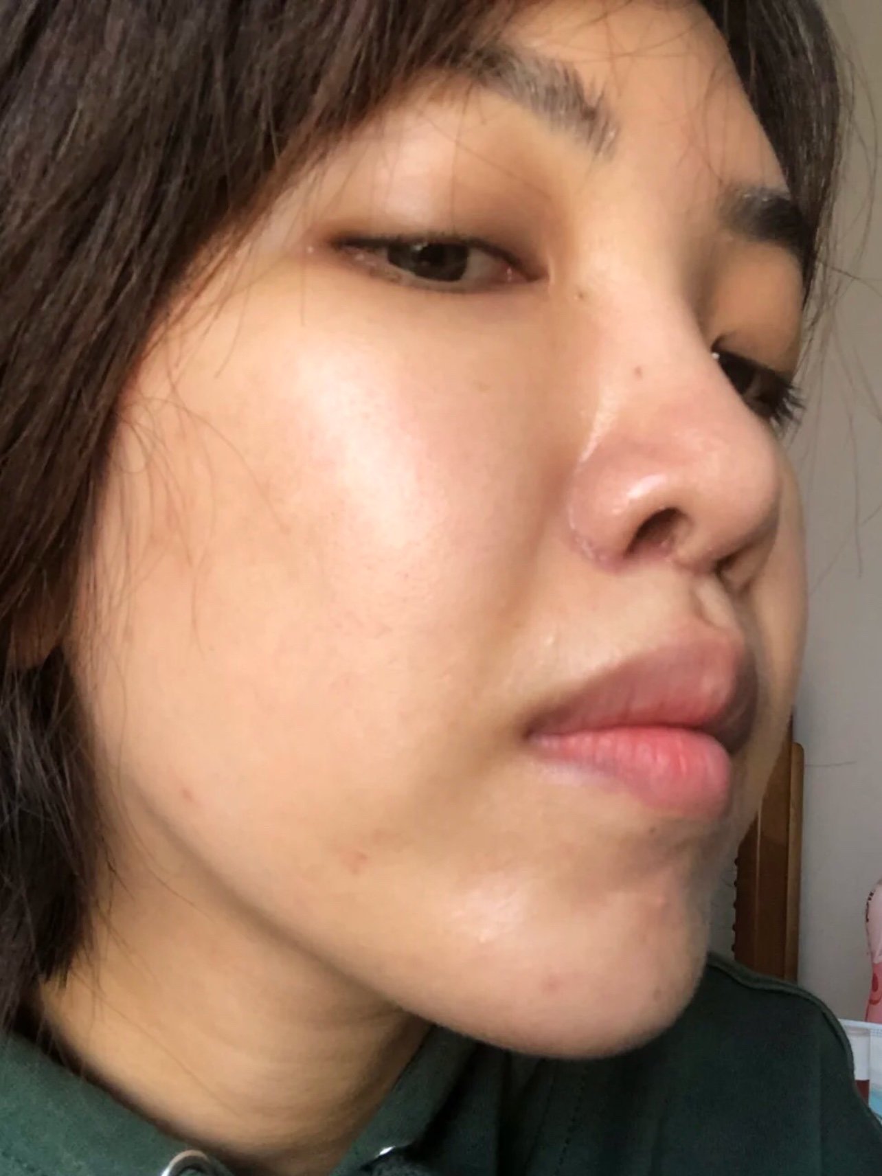 人中缩短29天,快满月了!