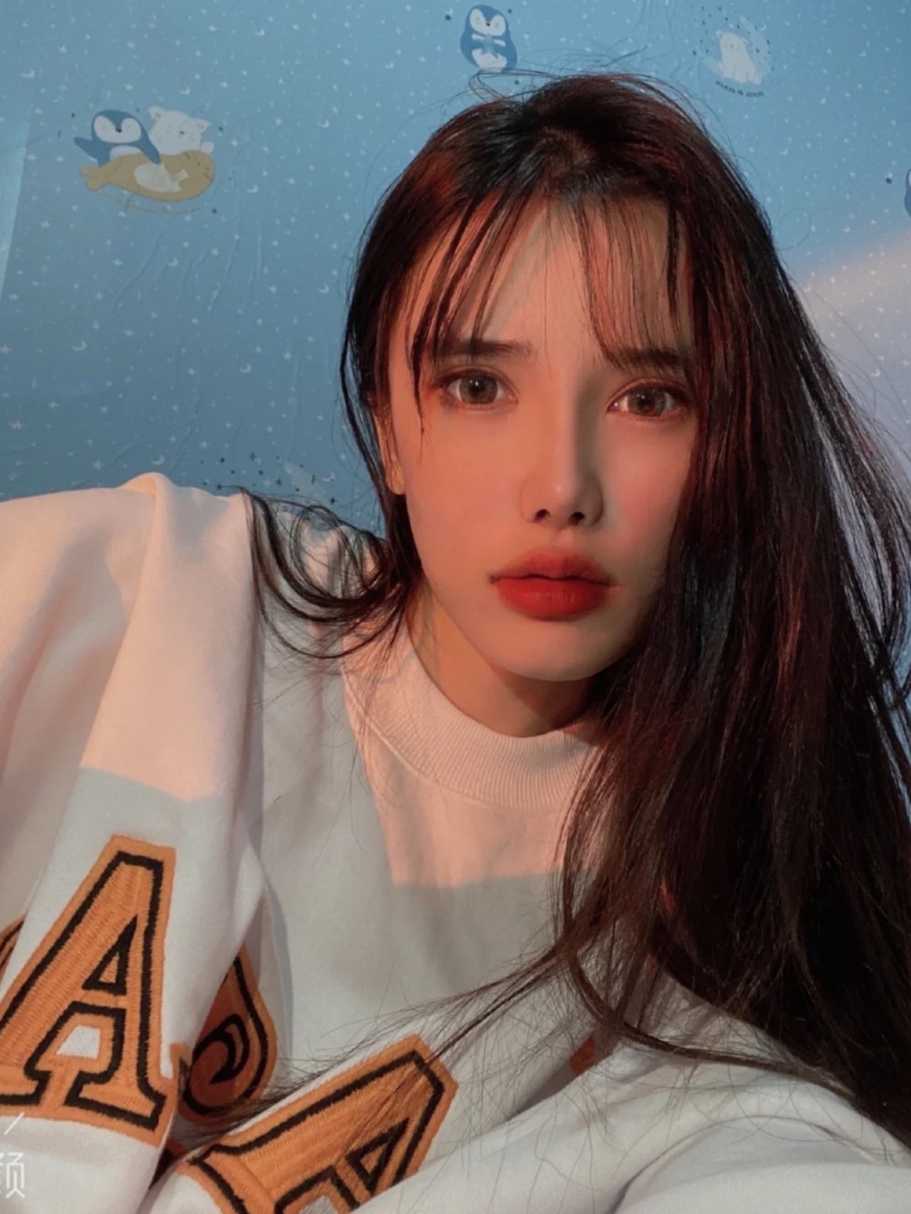 天生嘴巴就厚的我终于把m唇做了,虽然是小手术但开始_圈子-新氧美容