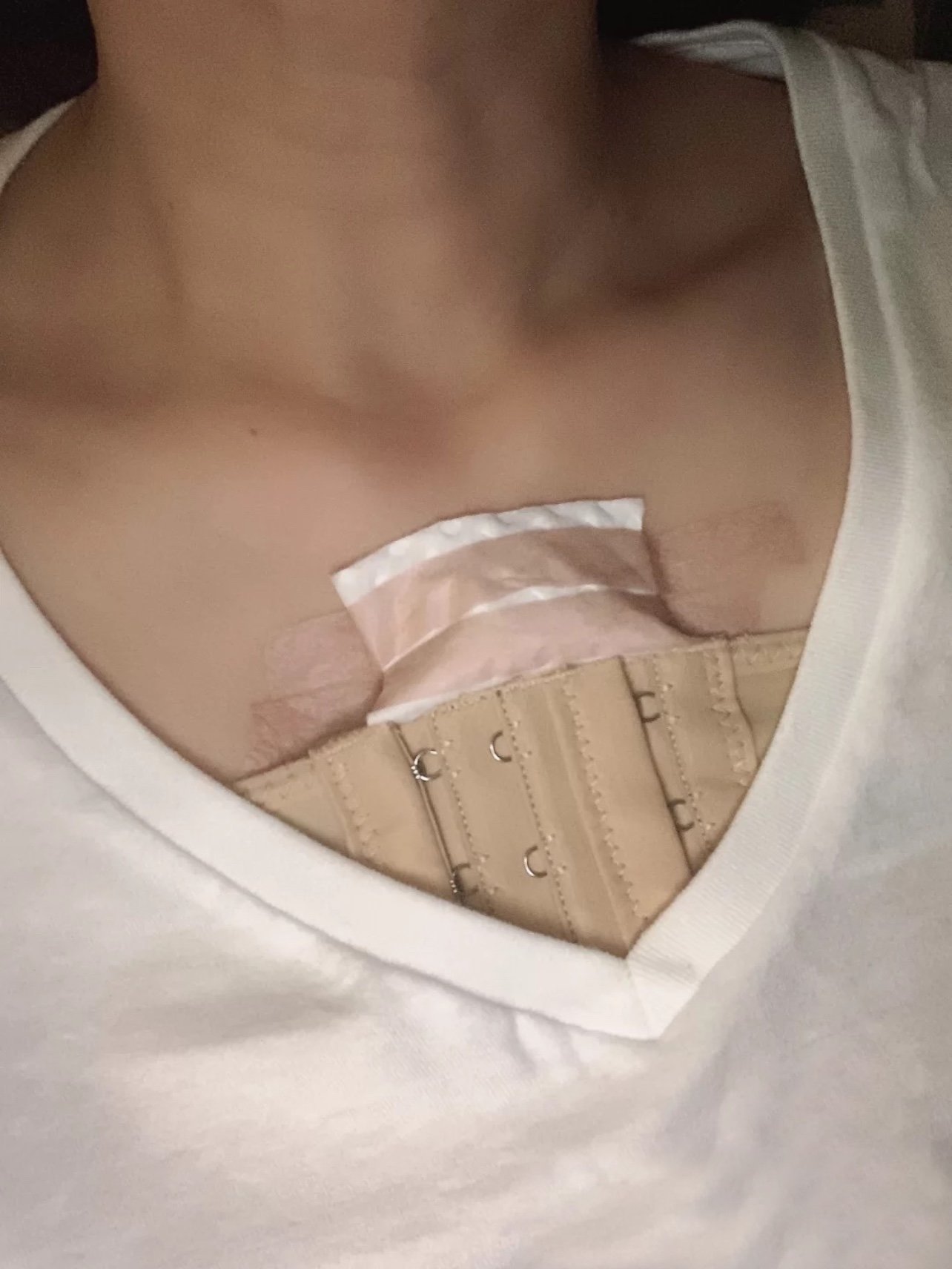 生完宝宝之后胸部下垂得厉害,忧伤.想当年本姑娘_圈子-新氧美容整形