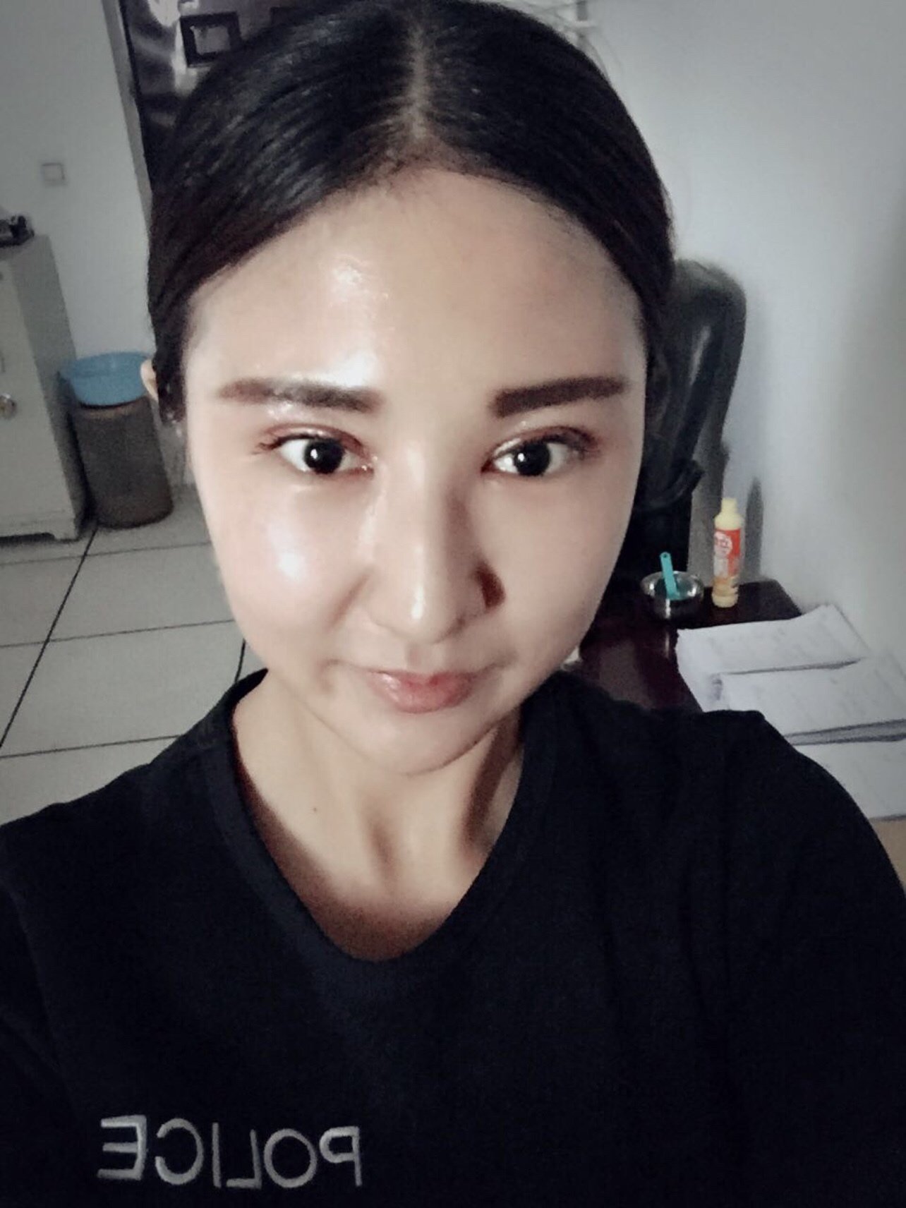 提眉术术后一个月效果反馈,术后带来的效果不是一星半_圈子-新氧美容