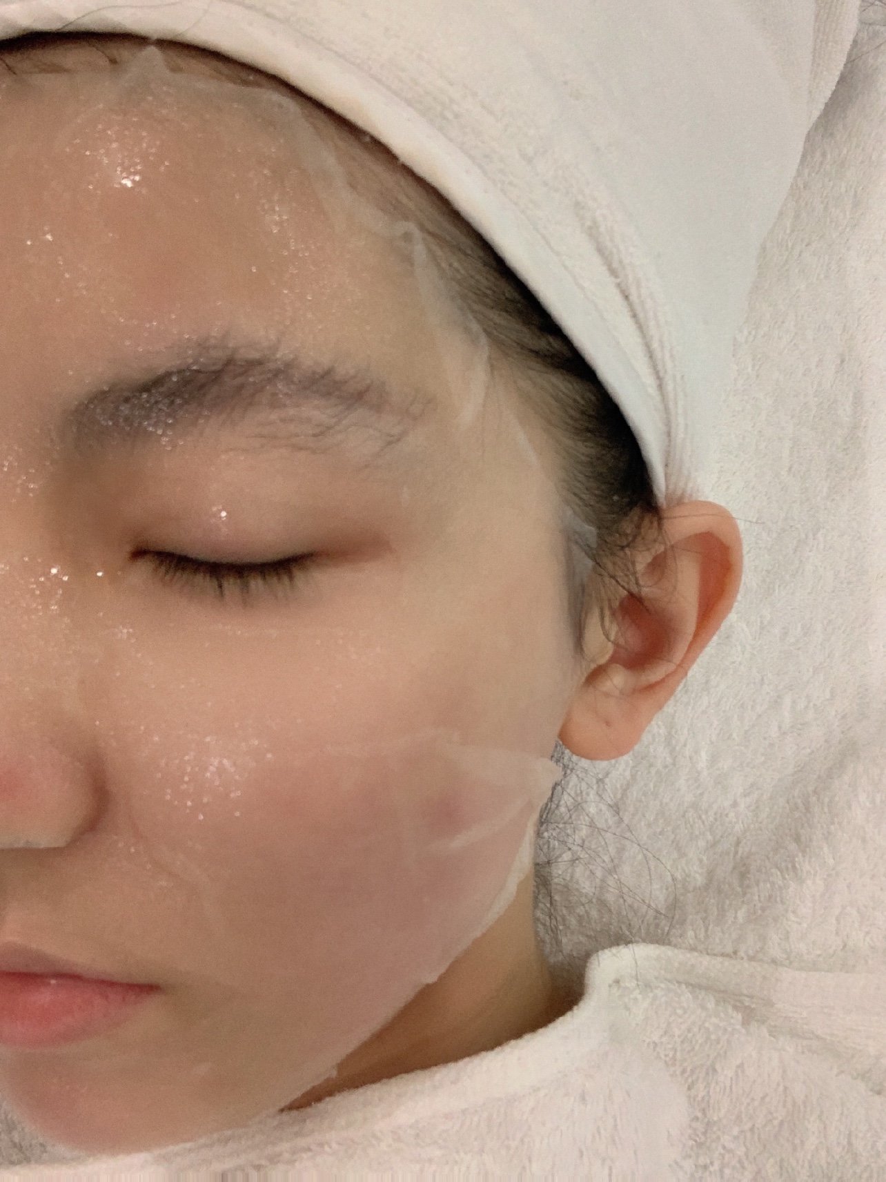 小气泡77无针水光78我的护肤最佳cp78