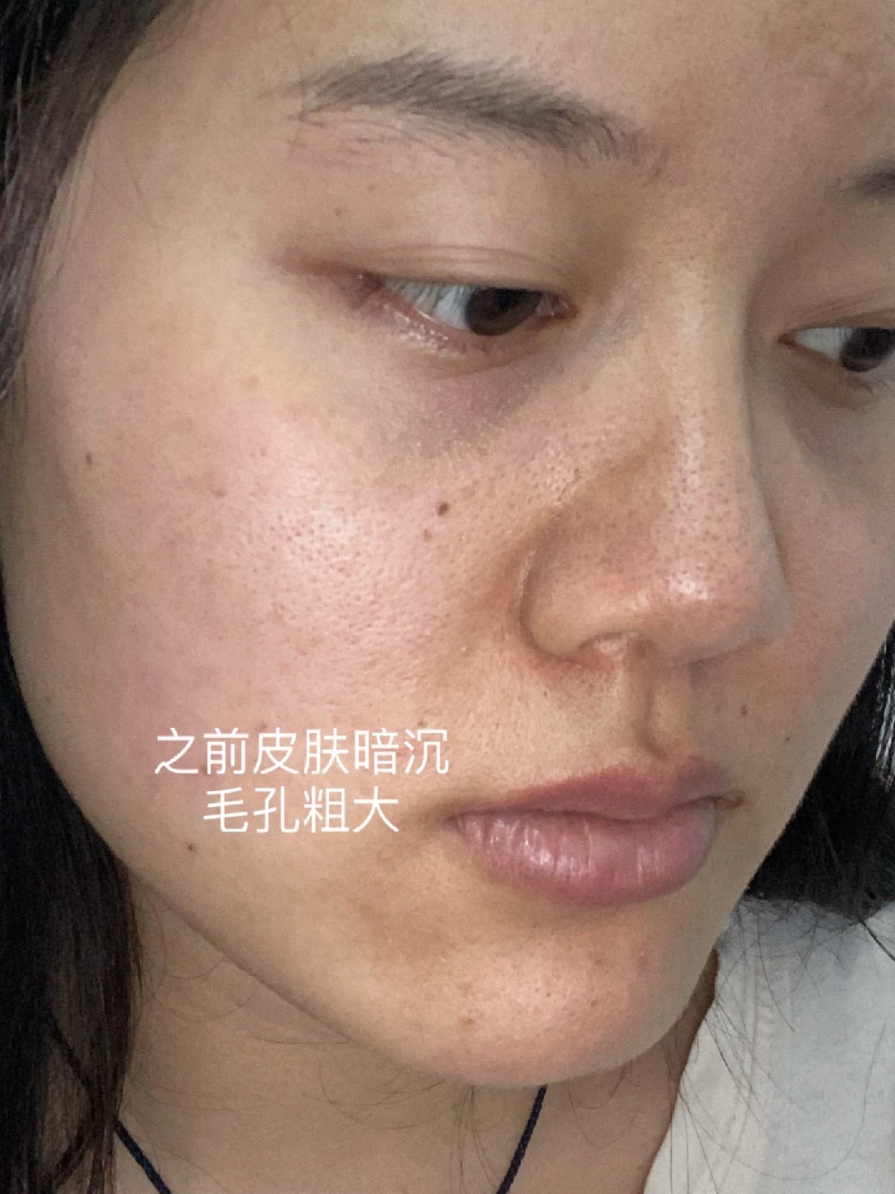 欧泉琳 欧泉琳 斑点毁掉整张脸 改掉7个易长斑的坏习惯