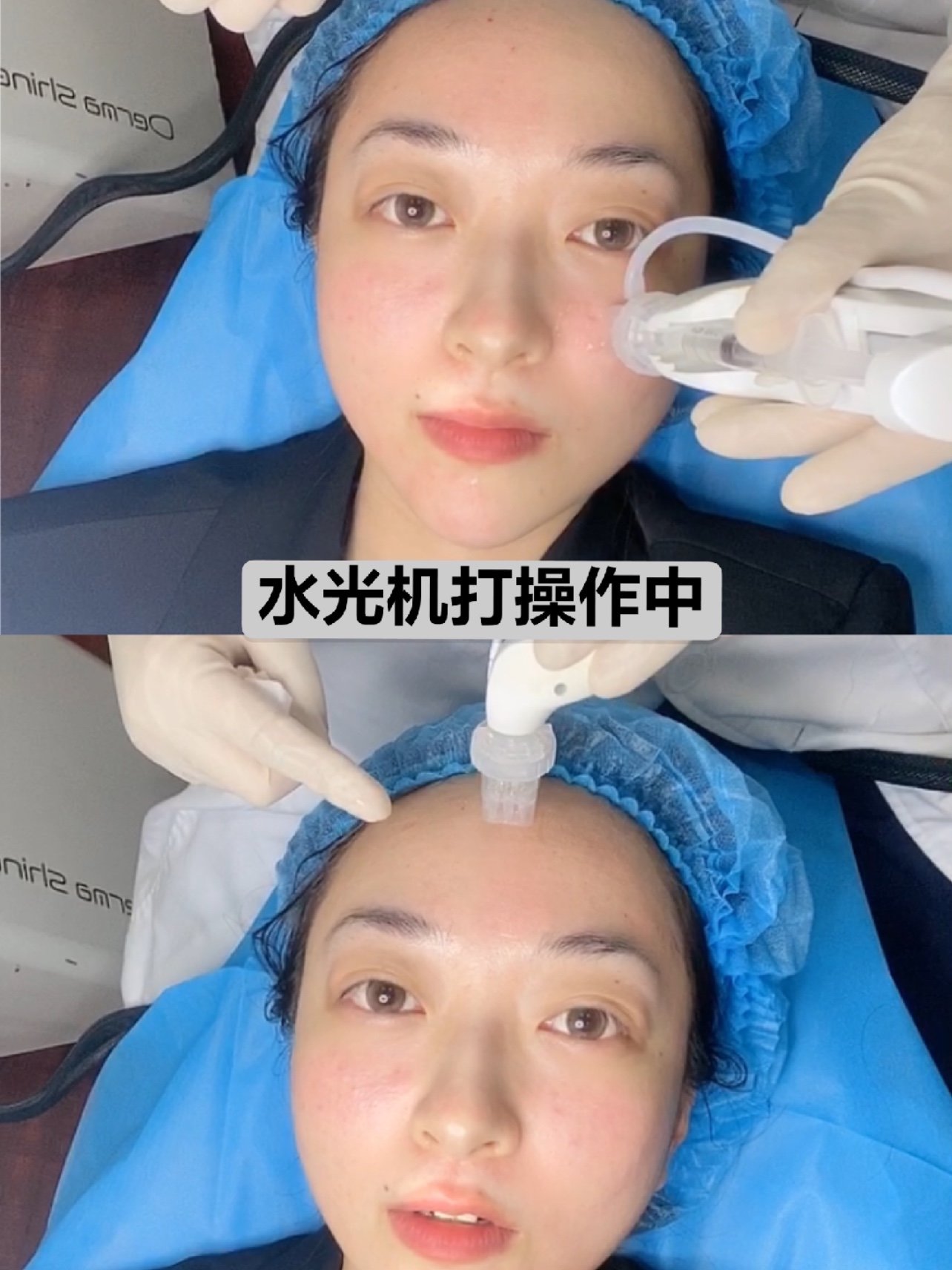 水光补水是非常普及化的医美项目了,甚至可以算得上一个每月定期保养