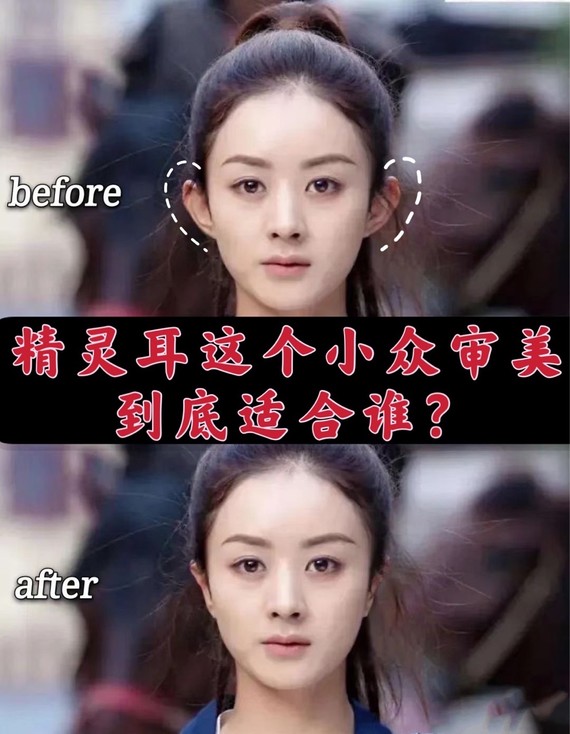 精灵耳这个小众审美到底适合谁