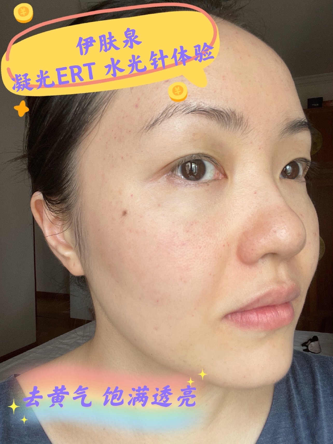 新氧体验官ert凝光水光