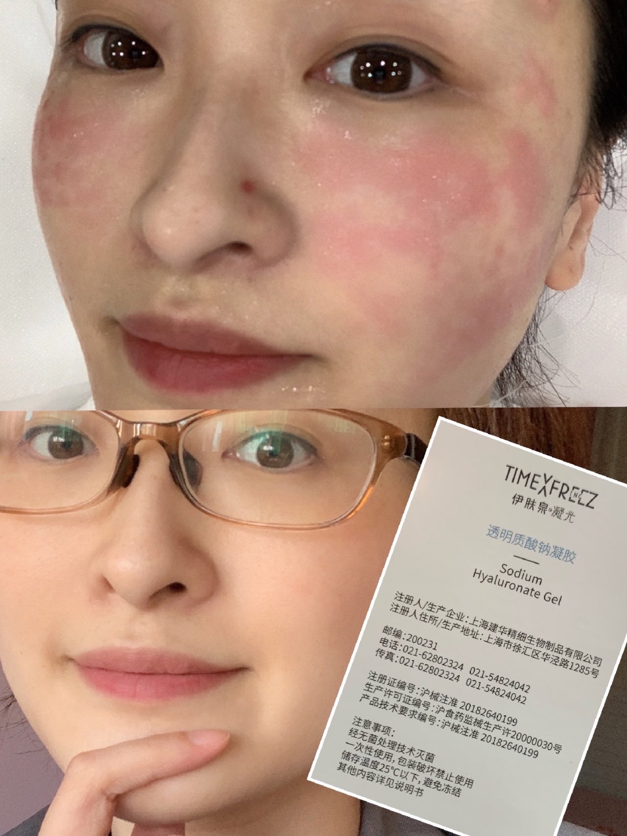 新氧体验官伊肤泉凝光