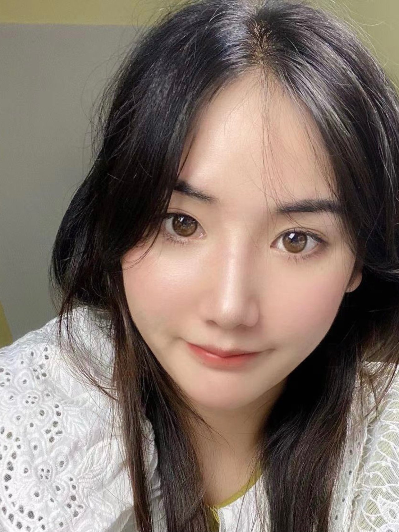 以前鼻子太大了,真的黑显老,明明才30岁,看起像4_圈子-新氧美容整形