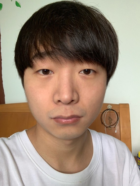 想缩鼻翼,鼻翼太供太厚,鼻翼沟也重,想咨询下什么内_圈子-新氧美容