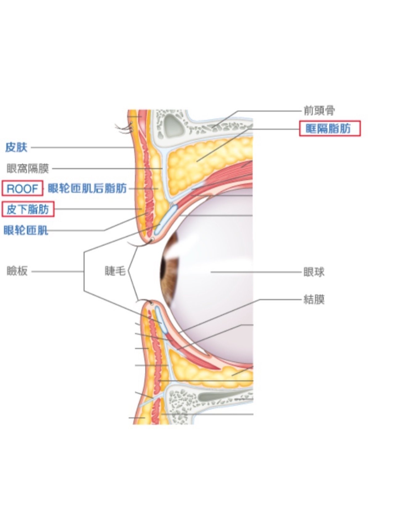 眶隔脂肪在哪里图片