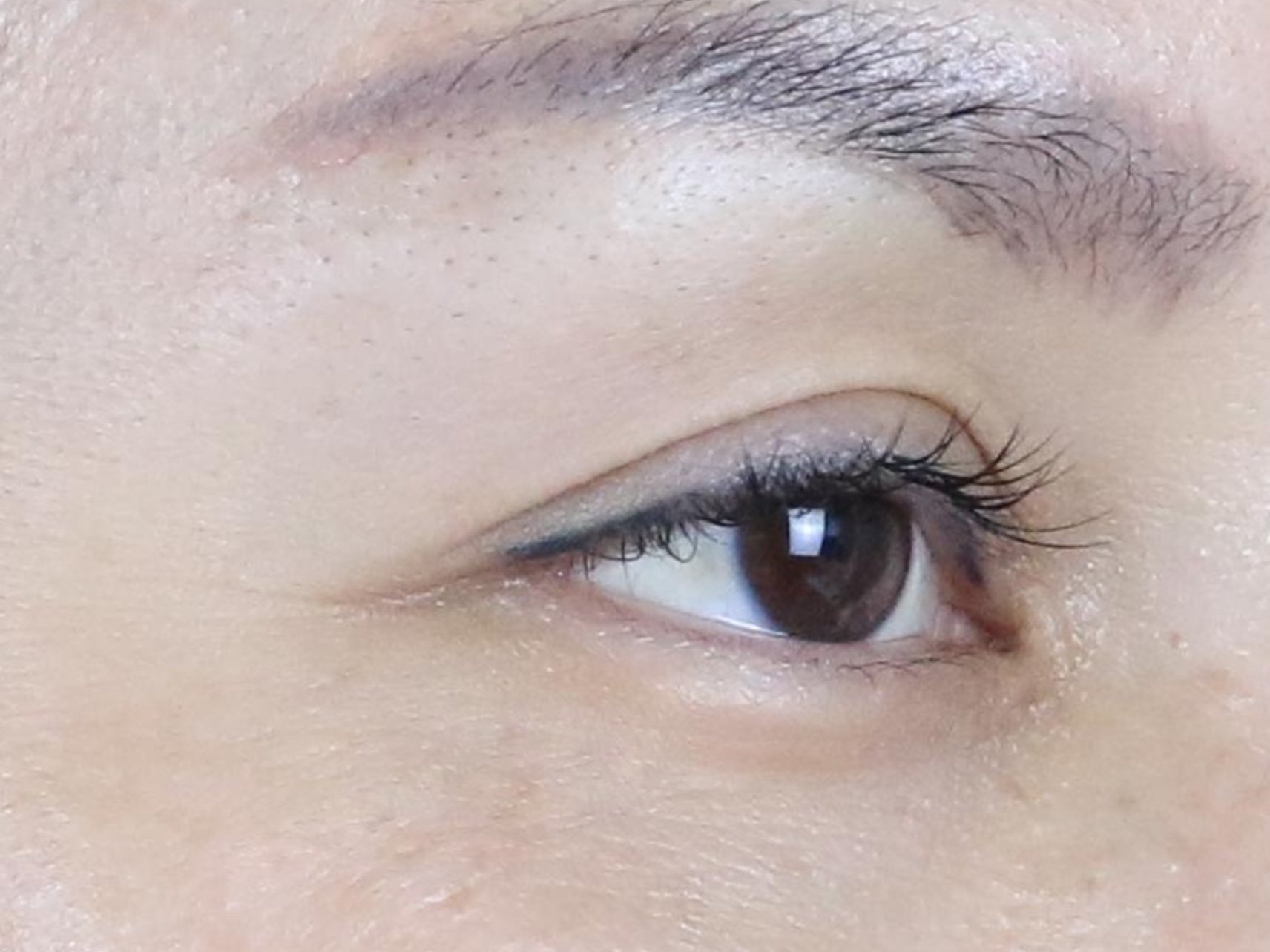 眼部肌肤粗糙干燥有细纹,笑起来有明显的鱼尾纹.