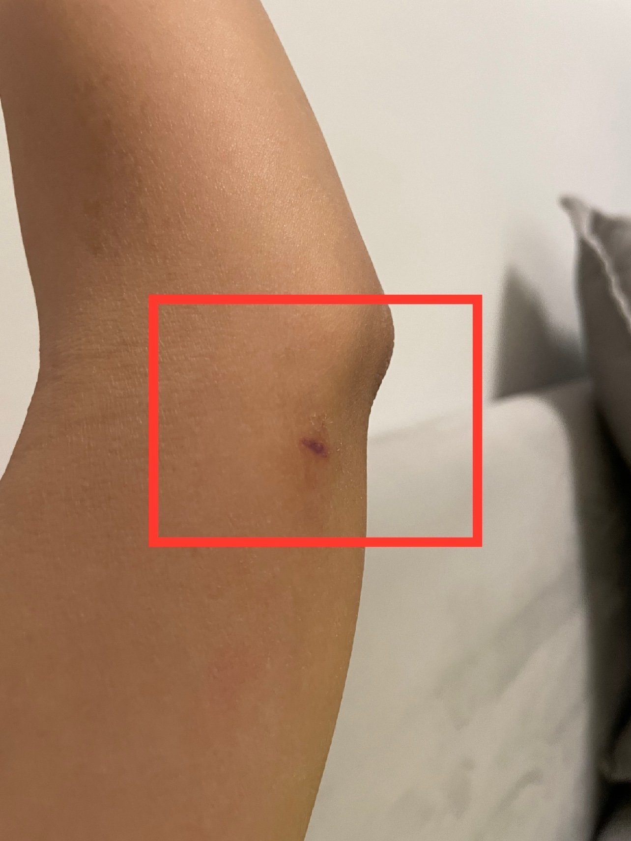 我做的是水动力腰腹环吸77妈妈臀77手臂77副乳本来我就不胖主要