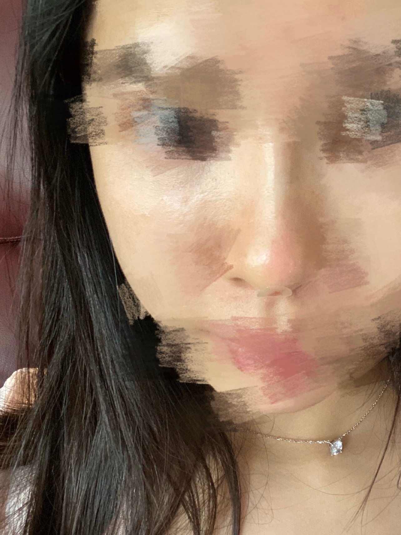 机构环境还不错,今天做的线雕鼻,做完即刻看到了效果_圈子-新氧美容