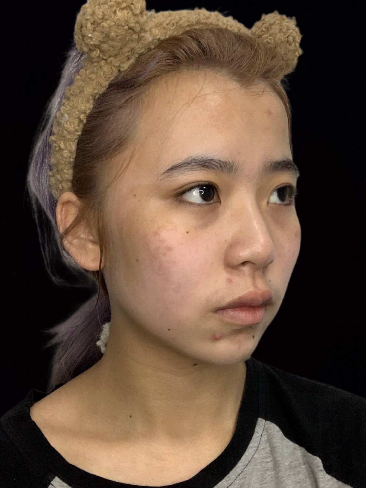 最近照镜子发现自己好恐怖啊,这脸蜡黄蜡黄的,这状态_圈子-新氧美容