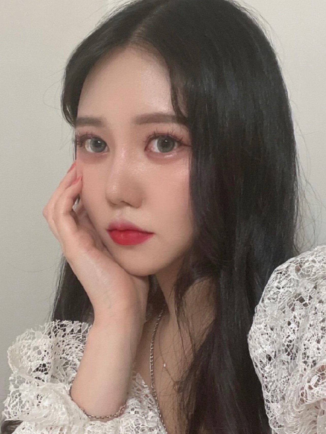 [:162]体验后效果:都说女孩子高鼻梁大眼睛才好_圈子-新氧美容整形