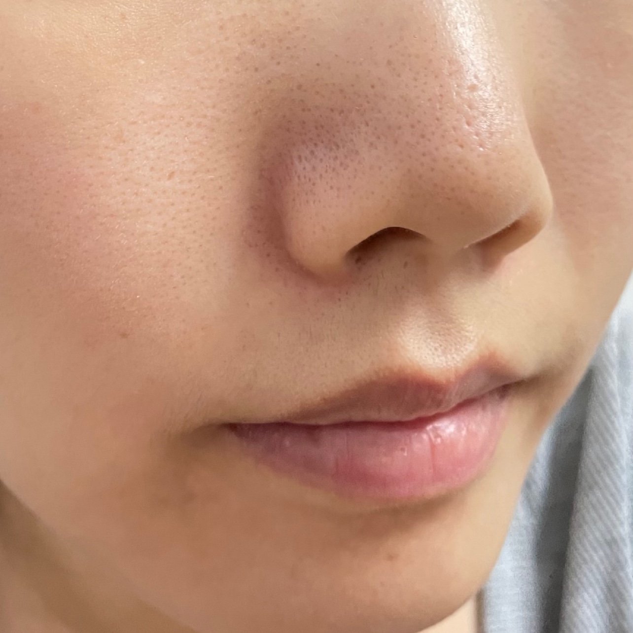女人鼻孔长鼻毛的照片图片