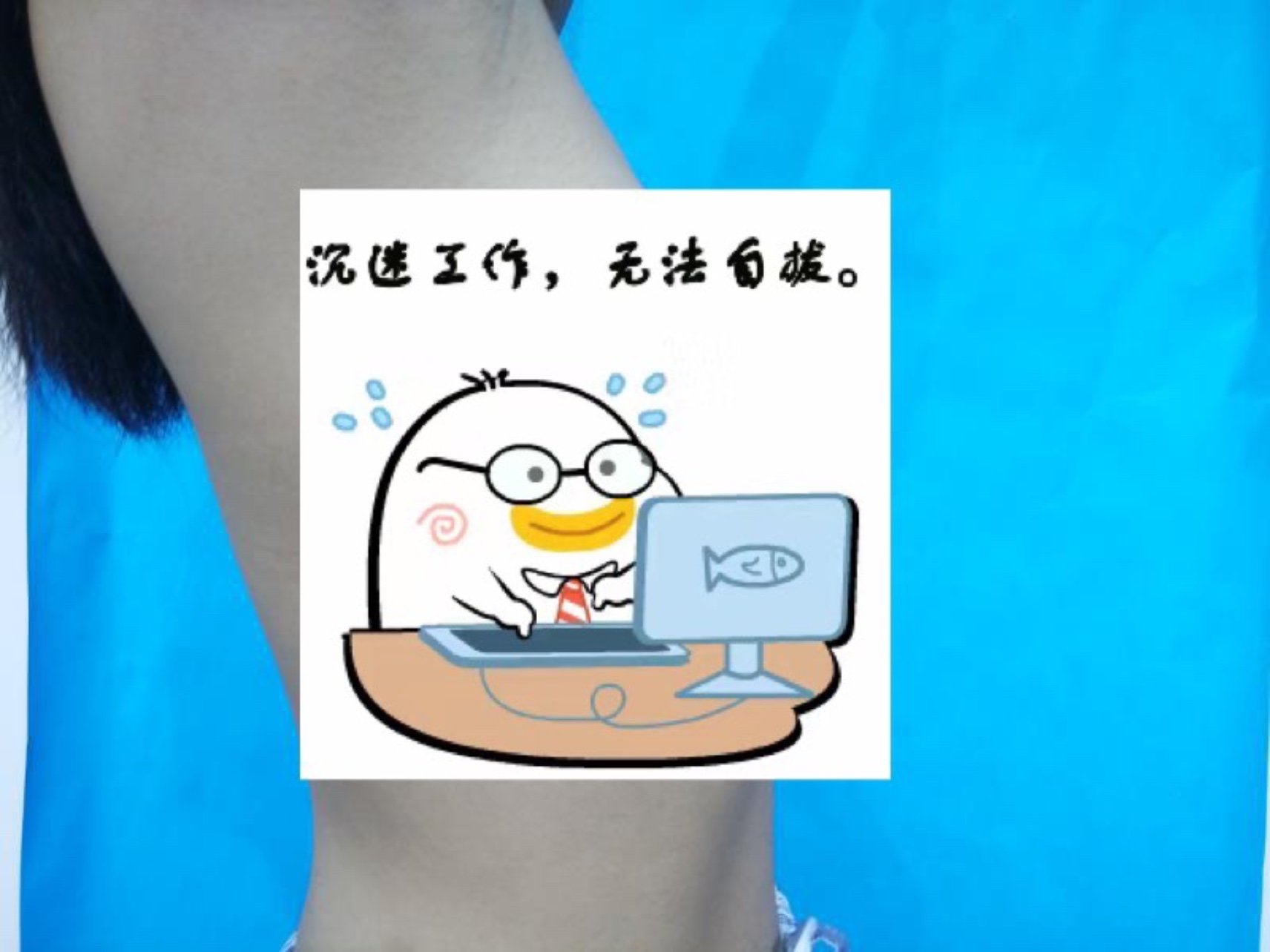 新氧上不了图片,全部盖住,我属于第三张图片中度下垂的情况