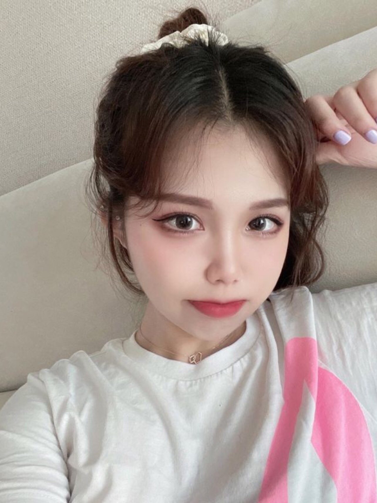 脸蛋完全是我自己想要的效果,饱满,自然,白里透红,_圈子-新氧美容整形