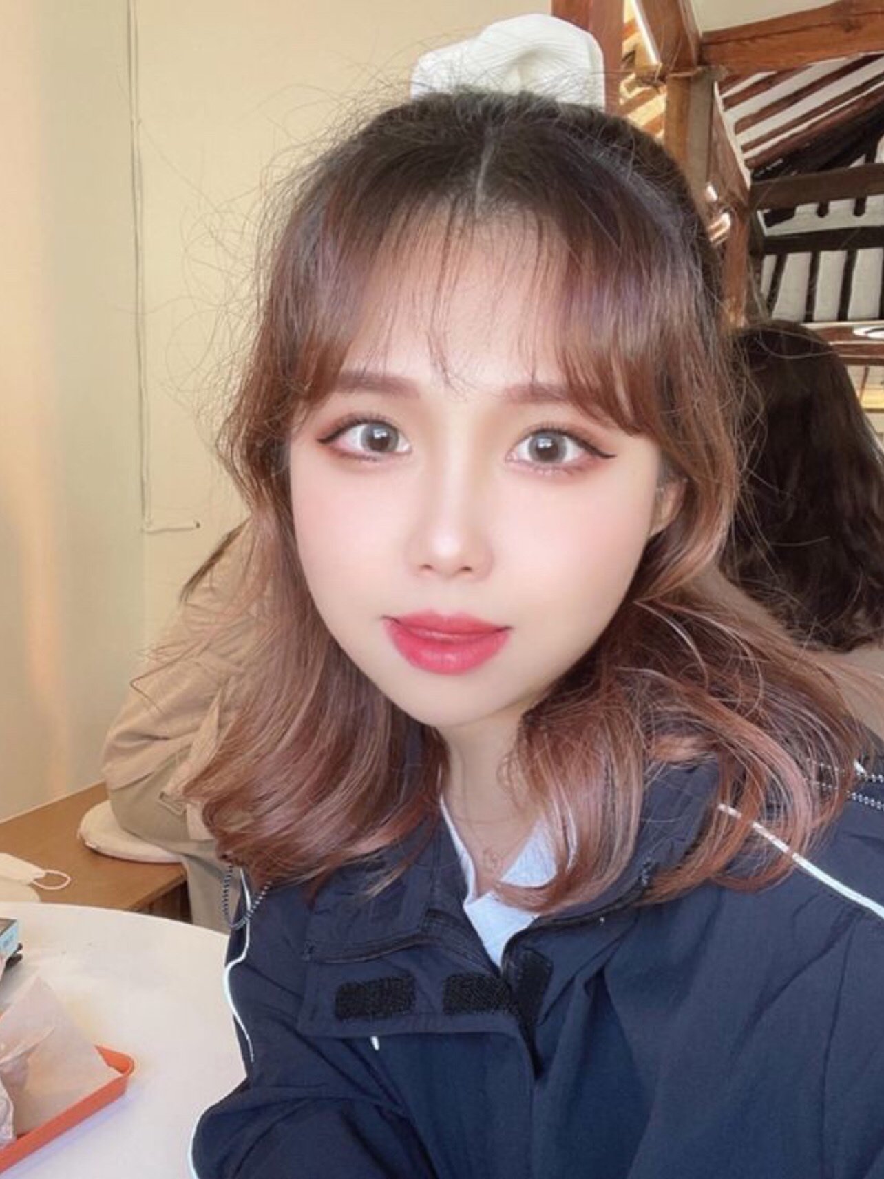 脸蛋完全是我自己想要的效果,饱满,自然,白里透红,_圈子-新氧美容整形