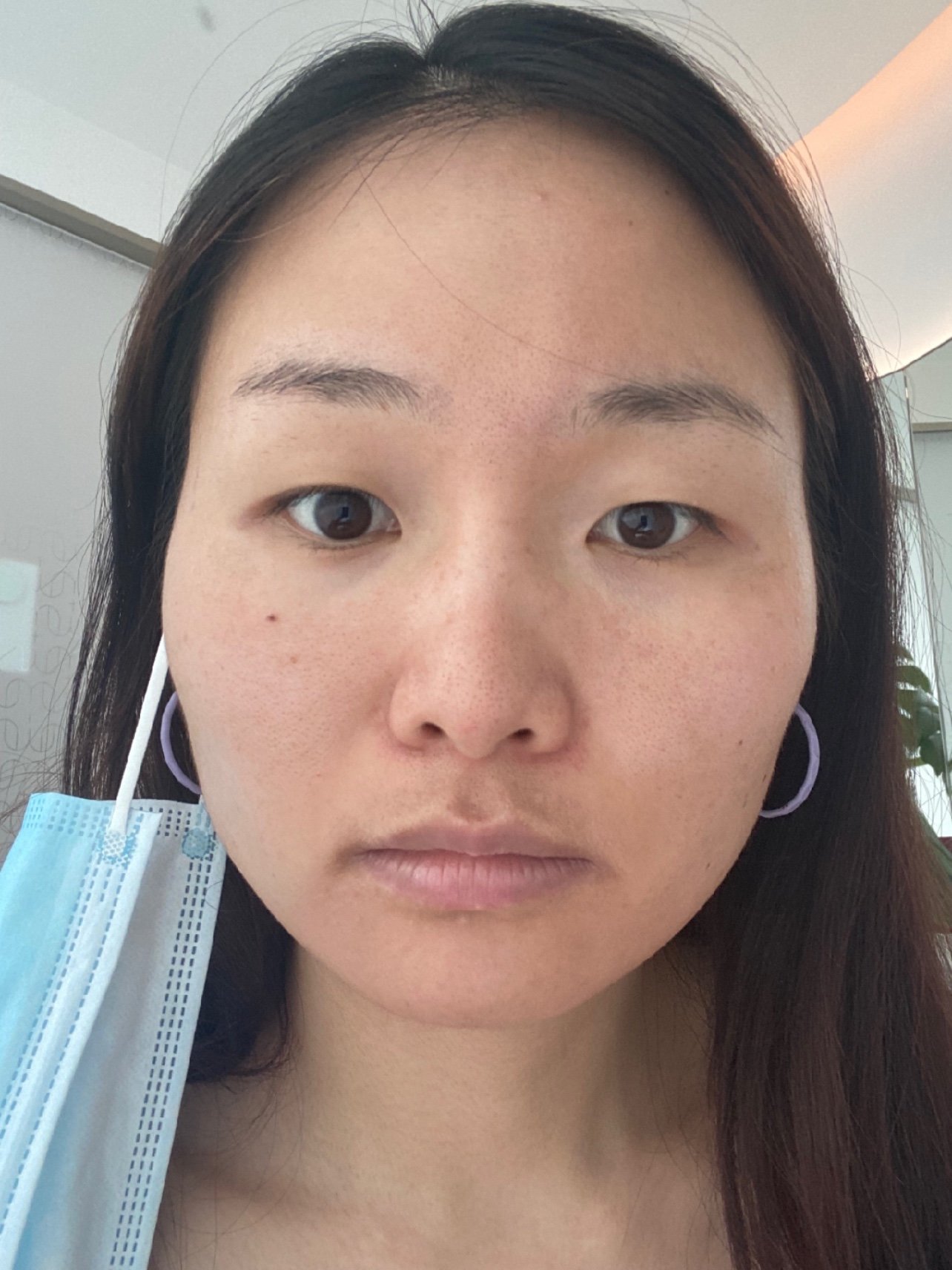 主要是想均匀肤色r暗沉同时也想改善小斑点