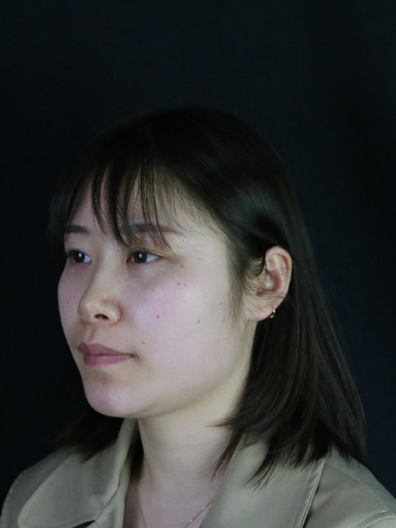 的面部吸脂_面部吸脂会不会导致皮肤松弛_面部吸脂价格大概多少钱