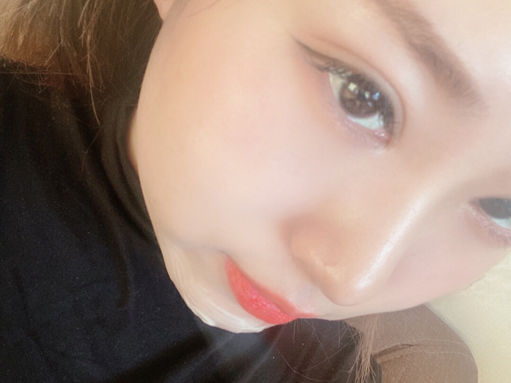 我是属于圆脸型婴儿肥的,一直想打个下巴修饰一下脸型_圈子-新氧美容