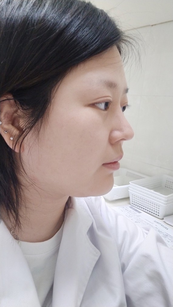 作为典型的直面脸做一个适合自己的鼻子挺重要的高度近_圈子-新氧美容