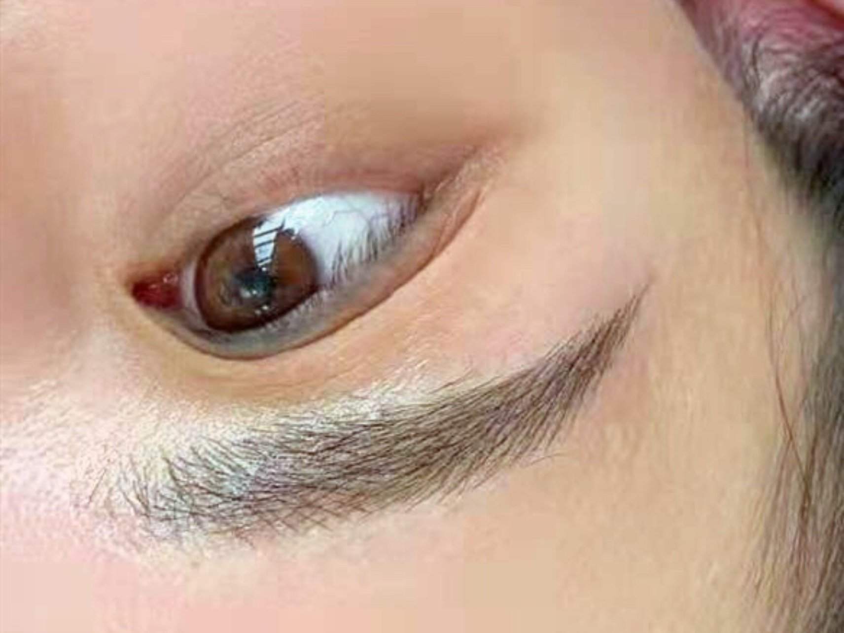 尤其是这对眉毛,无_圈子-新氧美容整形