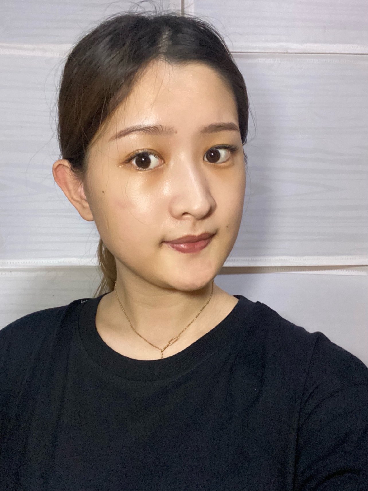 导致侧脸不好看的情况很多,但下颌角肥大和嘴凸这两种问题占比最大.