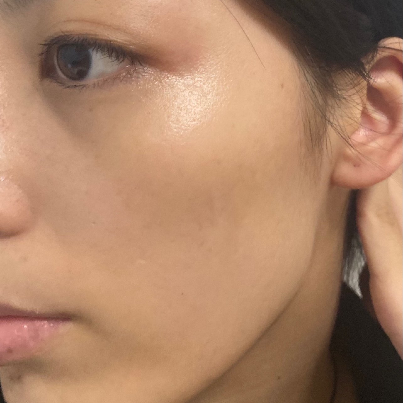 暗沉暗哑面部暗沉粗糙图片脸部暗沉暗哑图片皮肤肤色不均肌肤粗糙暗哑