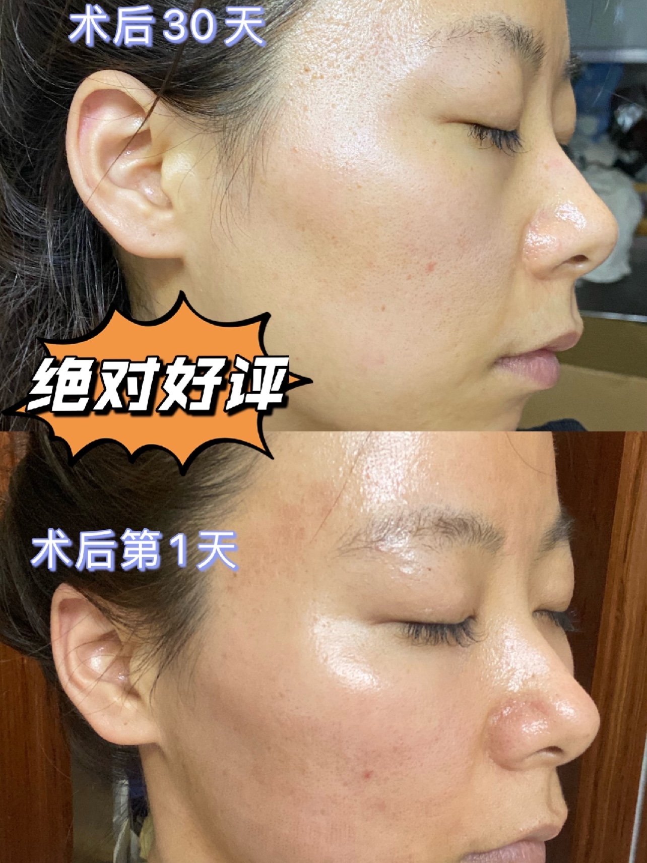 早鸟体验官x半岛黄金射频英诺小棕瓶