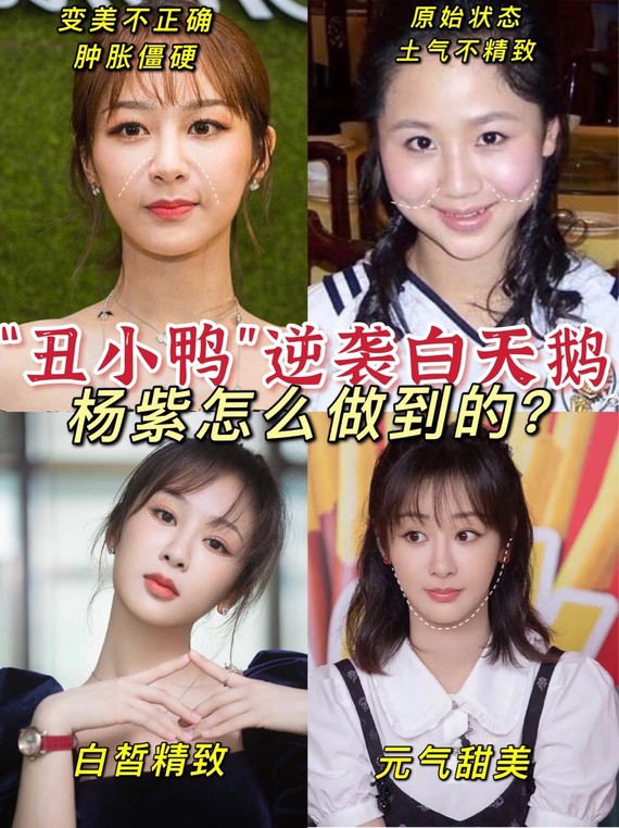 审美讨论丨杨紫从丑小鸭逆袭成白天鹅现在的她简直是甜美仙女本人啊